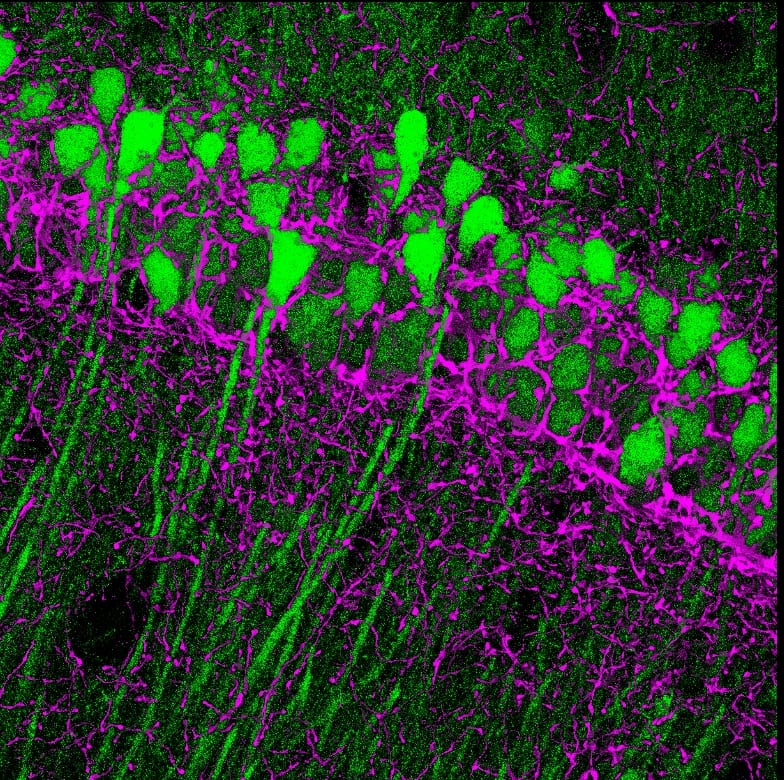 Cannabinoid_receptors_in_the_hippocampus